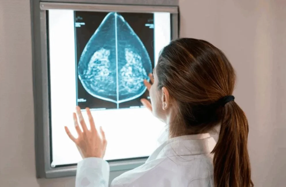 Cáncer de mama: un nuevo estudio confirma que muchas pacientes podrían evitar la radioterapia tras la mastectomía
