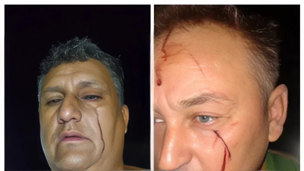 Feroz ataque a un camionero y su acompañante
