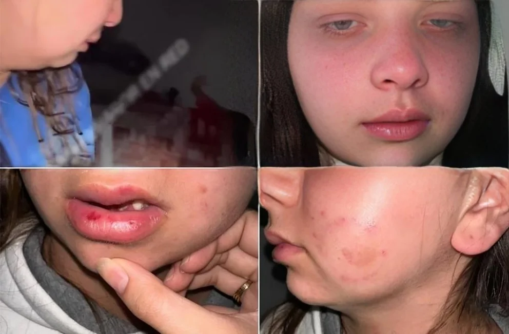 La sacó de una fiesta, la llevó de los pelos a su casa, la golpeó como tantas veces y la Justicia solo le impuso una restricción de acercamiento
