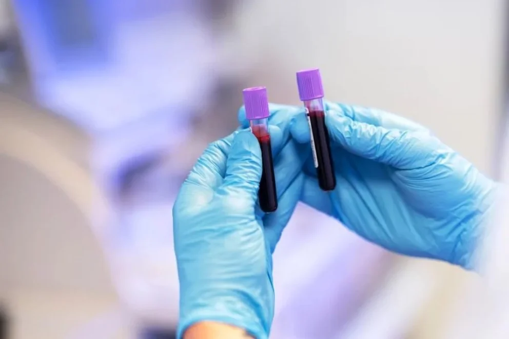 Un nuevo método avanza hacia la detección del cáncer con un análisis de sangre
