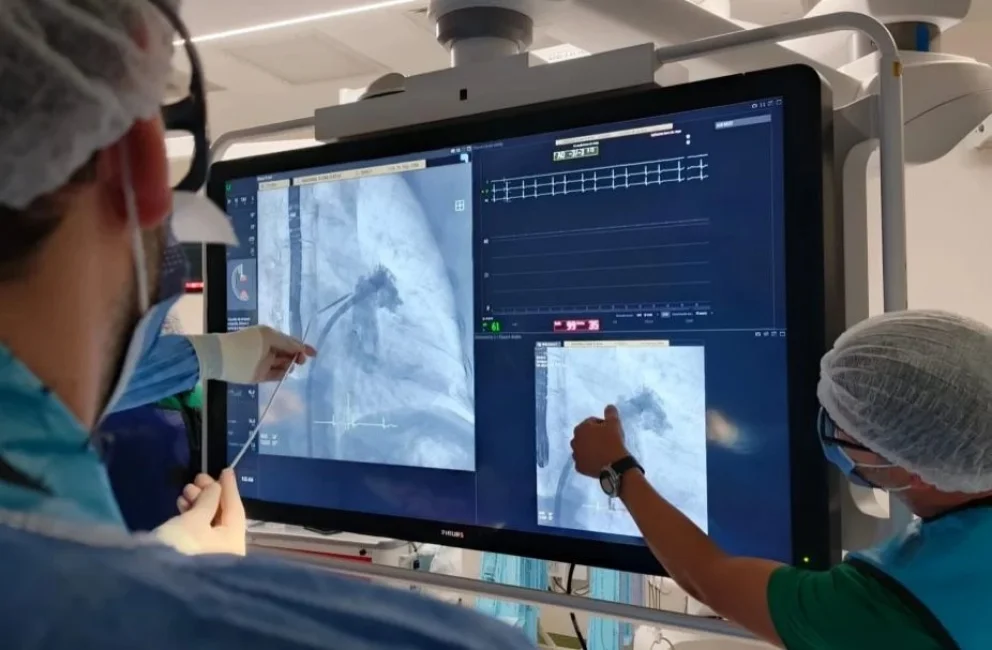 El sistema público de salud realizó por primera vez un procedimiento cardiológico de alta complejidad

